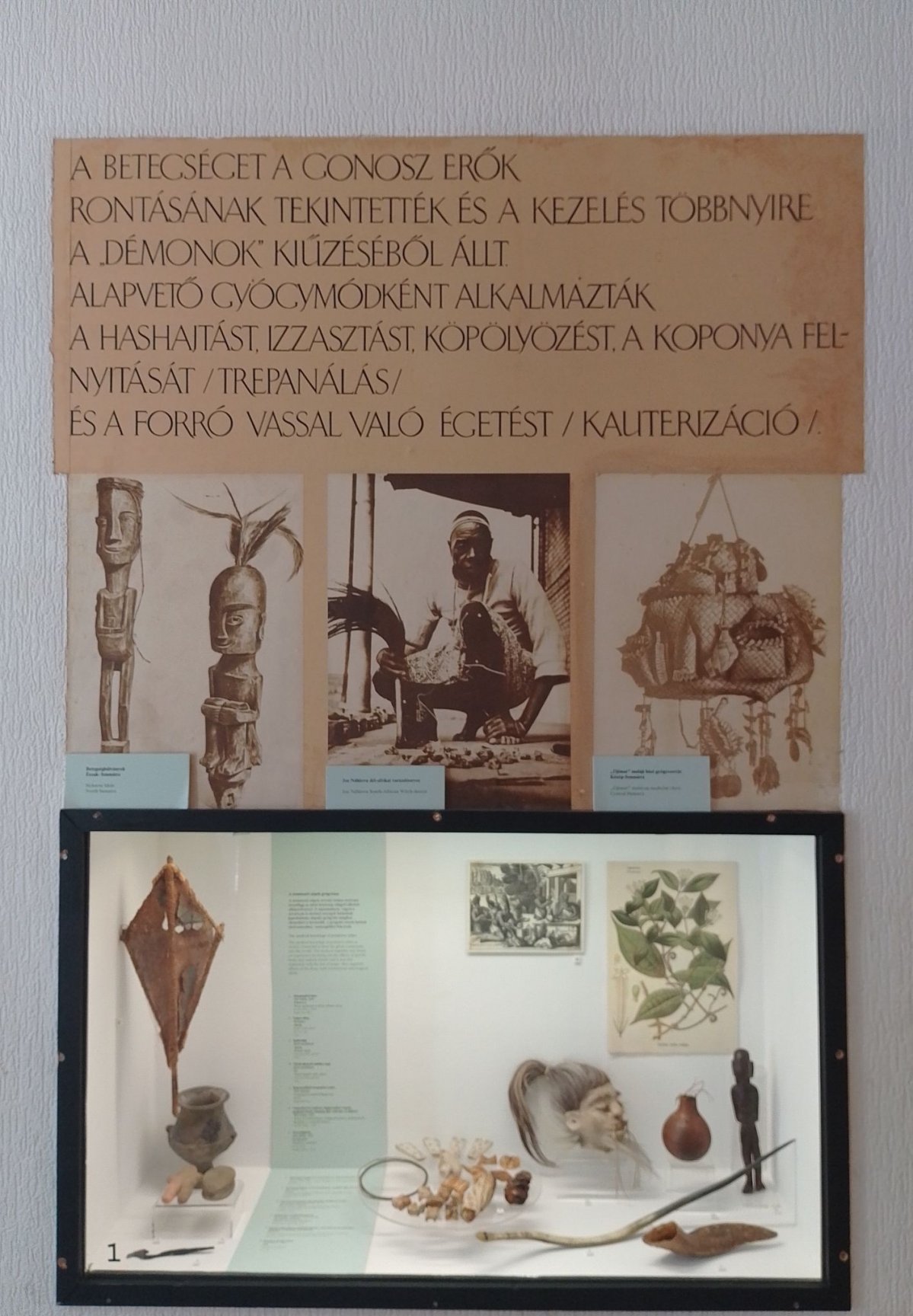 Az orvostörténeti kiállítás egyik fali vitrinje (Fotó: Bodó Péter/pestbuda.hu) 07 vitrin.jpg